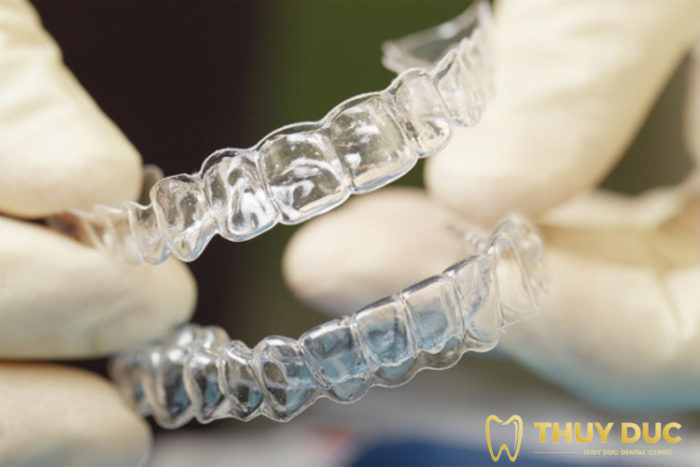 Advantages and disadvantages of Invisalign clear braces 1 Advantages and disadvantages of Invisalign clear braces 1