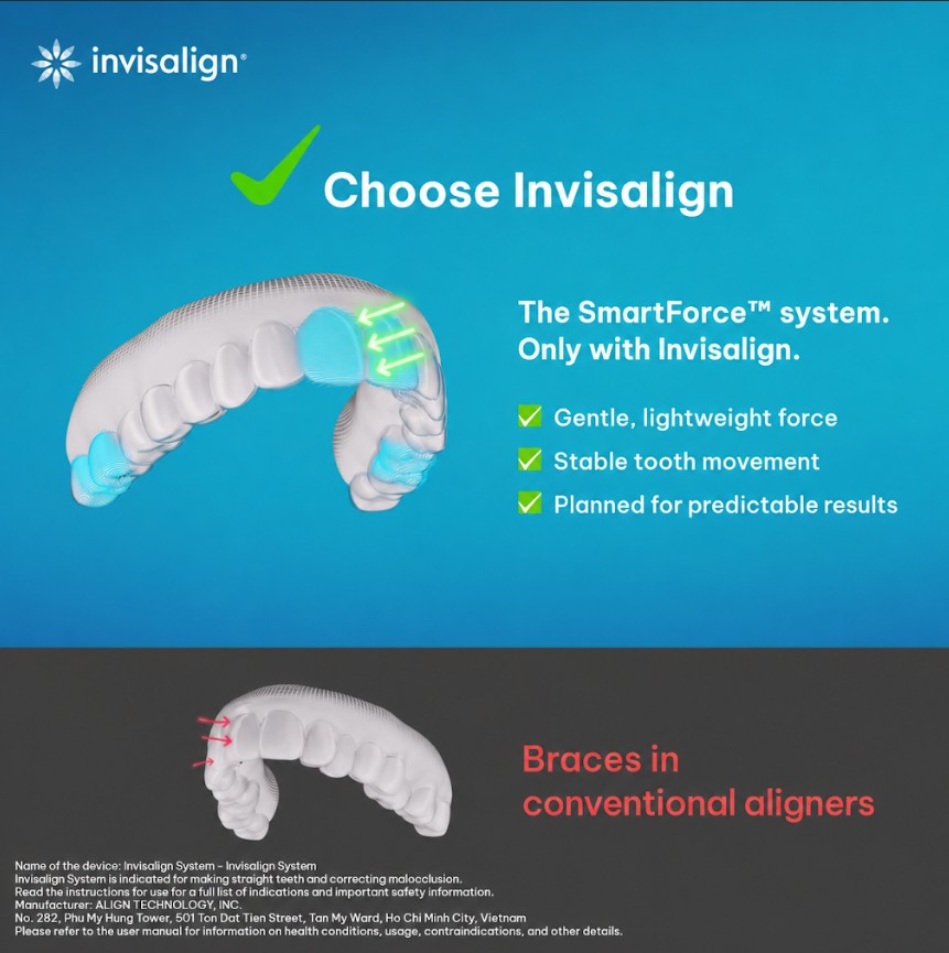 Invisalign Technology & Materials – The Foundation for Treatment Effectiveness 2 Invisalign Technology & Materials – The Foundation for Treatment Effectiveness 2