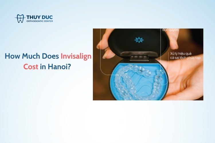 How Much Does Invisalign Cost in Hanoi?