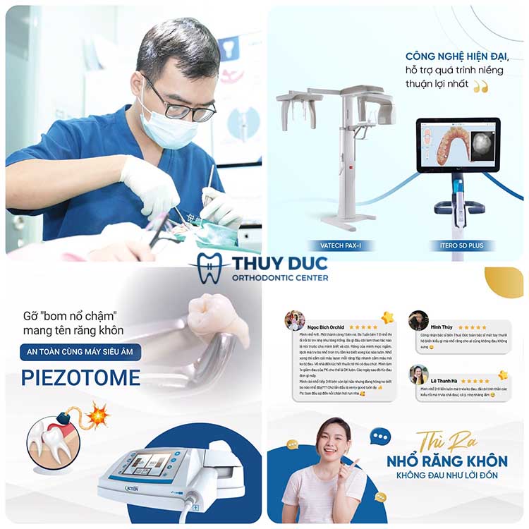 Nhổ răng khôn tại Nha khoa Thúy Đức
